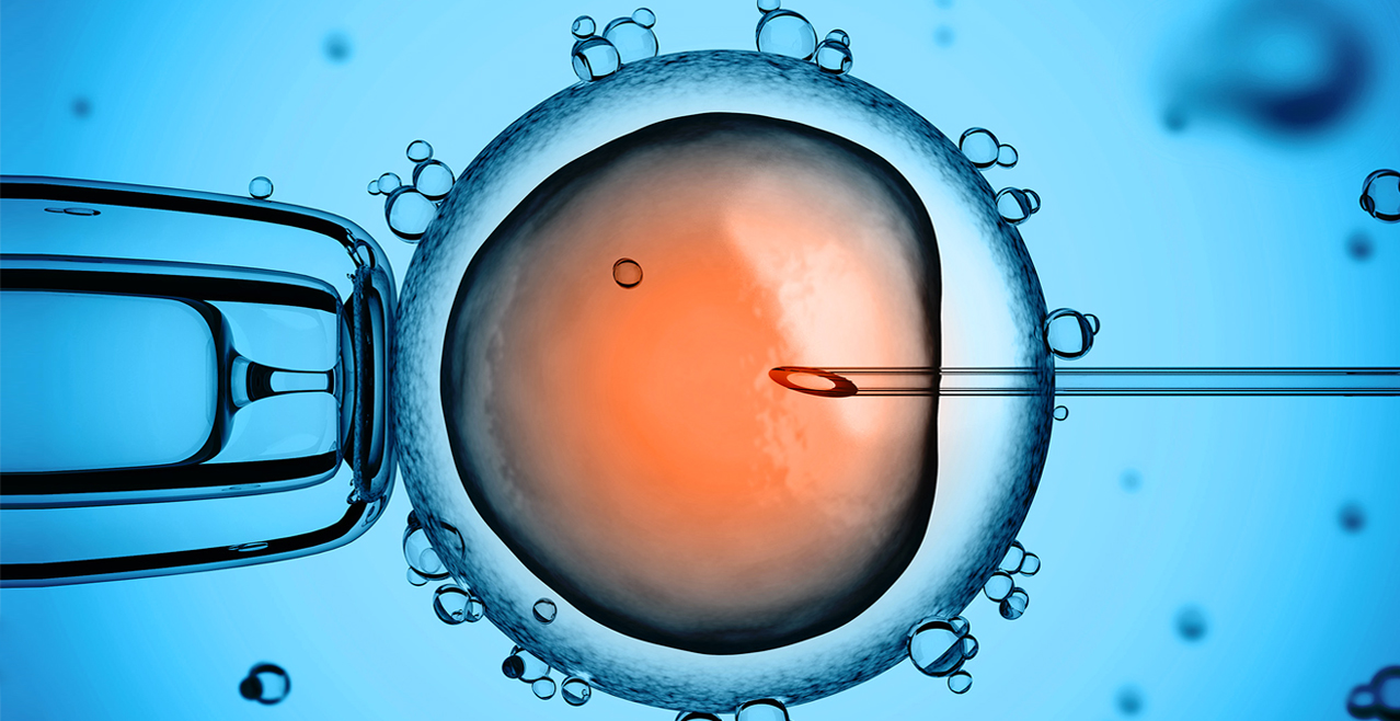 ICSI (Iniezione Intracitoplasmatica dello Spermatozoo)